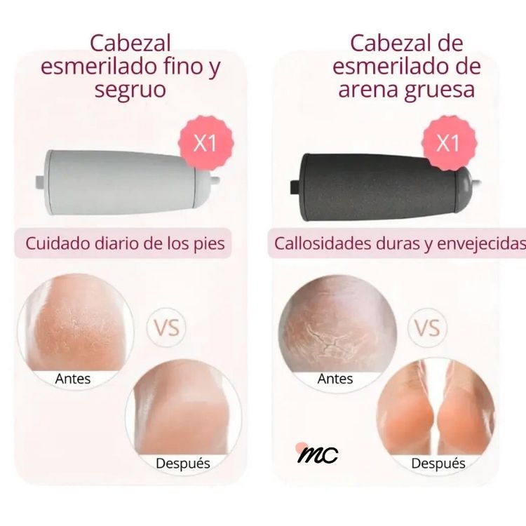 Lima Pedicura VelouFeet® – Pies feos Nunca más.