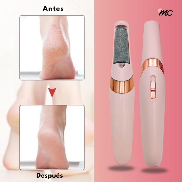 Lima Pedicura VelouFeet® – Pies feos Nunca más.